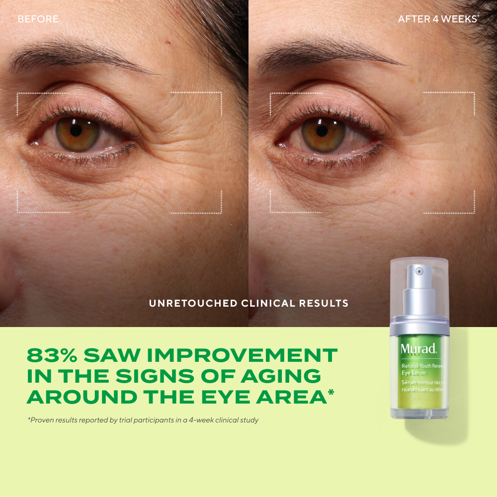 Derm Clinic: Target Eye Wrinkles Value Set