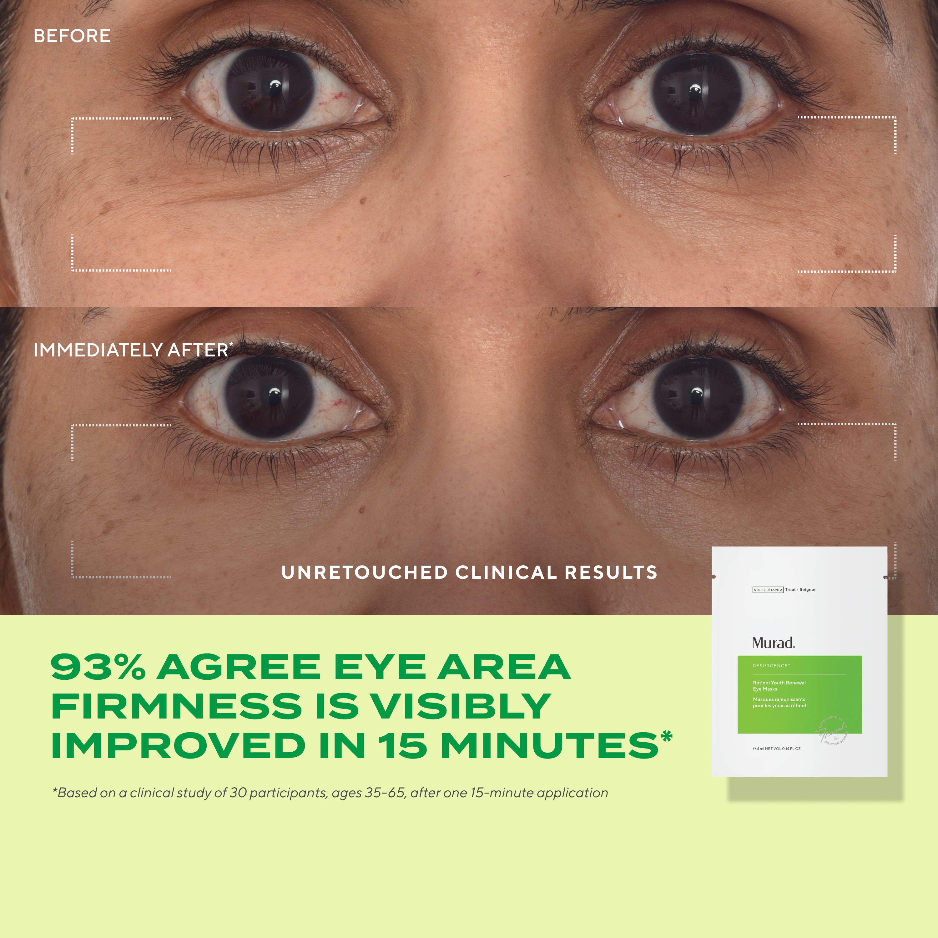 Derm Clinic: Target Eye Wrinkles Value Set